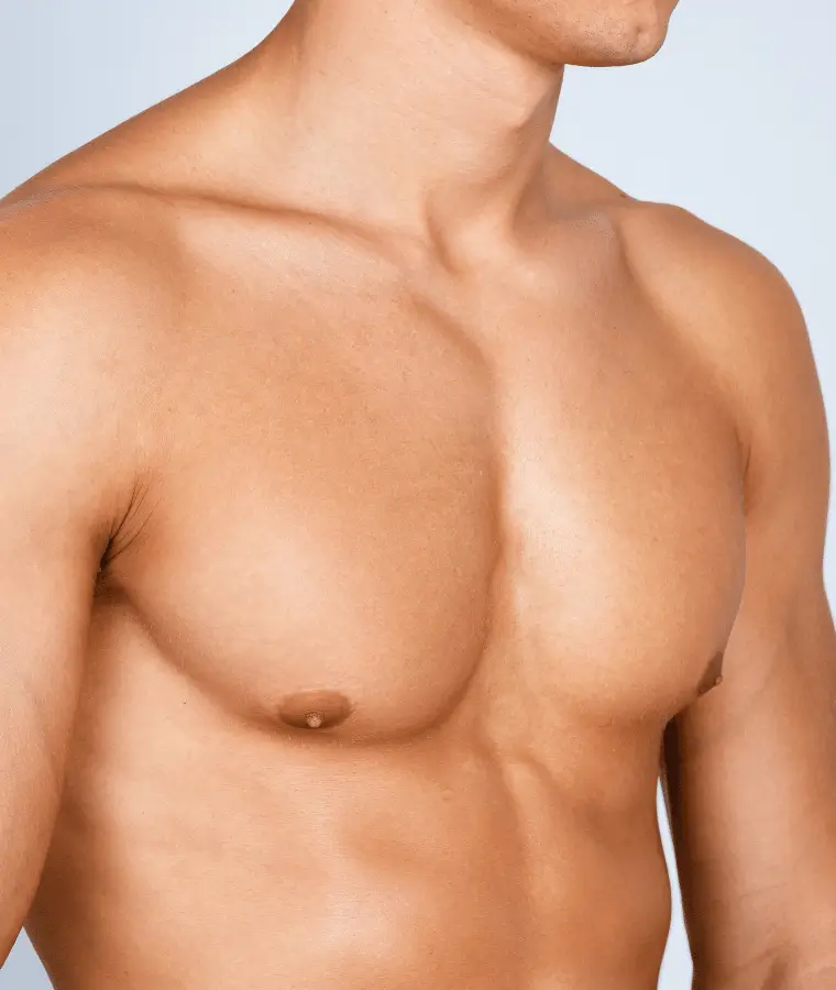 Gynecomastia harmonious male chest - Dr Stéphane Raoult plastic surgeon