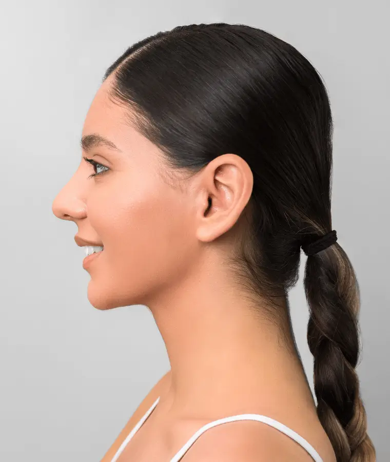 Otoplasty protruding ears harmonious profile - Dr Stéphane Raoult plastic surgeon