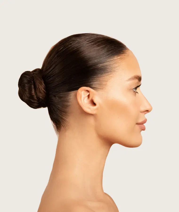 Rhinoplasty harmonious nose profile - Dr Stéphane Raoult plastic surgeon